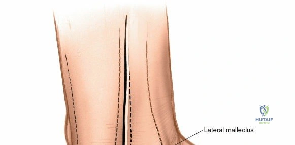 Clinical Image