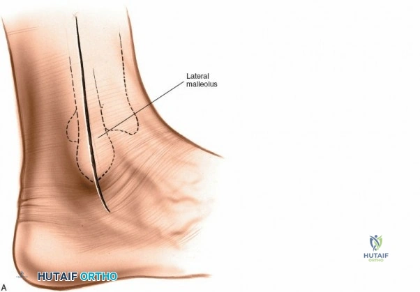 Clinical Image