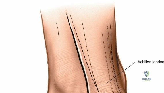 Clinical Image