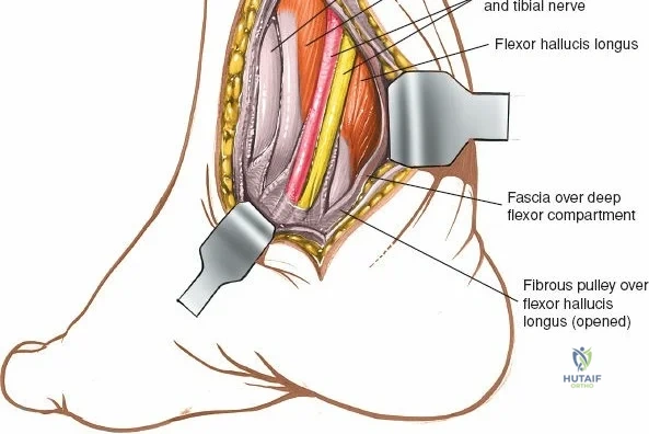 Clinical Image
