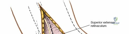Clinical Image