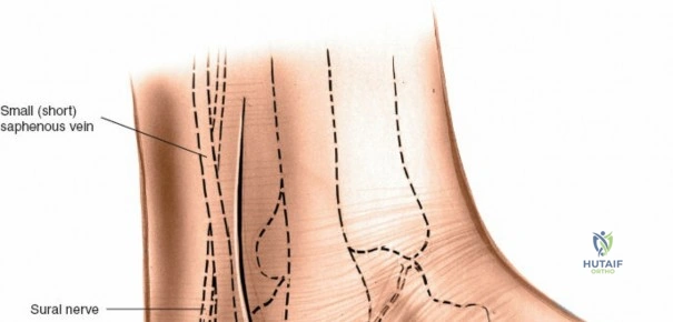 Clinical Image