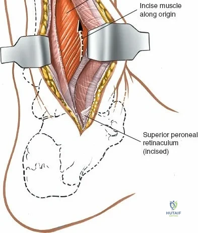 Clinical Image