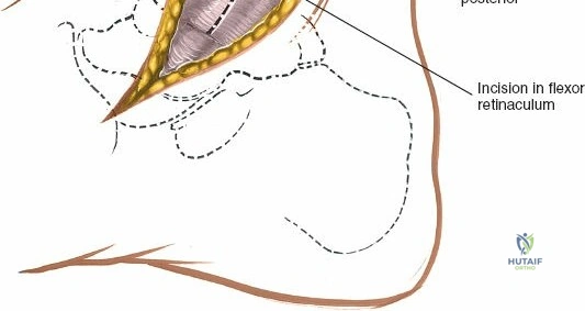 Clinical Image