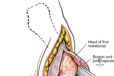 Clinical Image