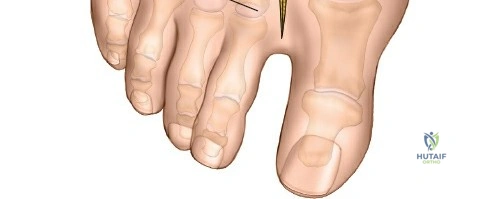 Clinical Image