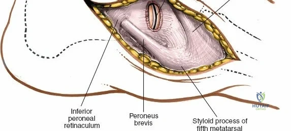 Clinical Image