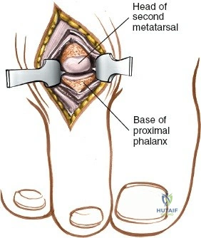Clinical Image