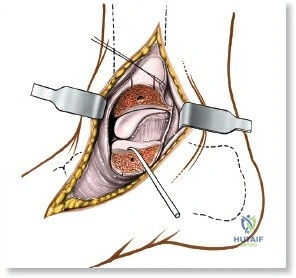 Clinical Image