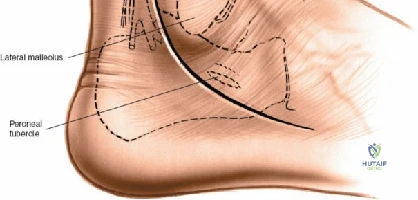 Clinical Image