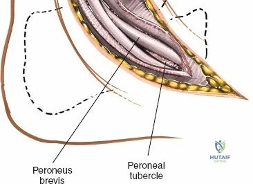 Clinical Image