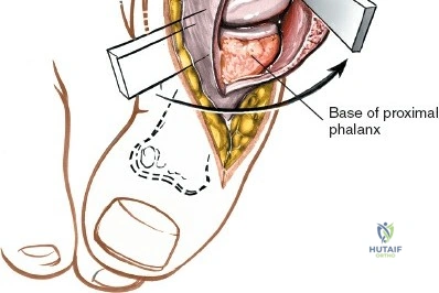 Clinical Image