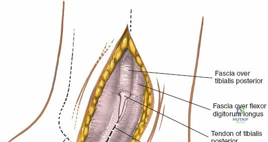 Clinical Image