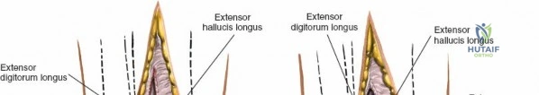 Clinical Image