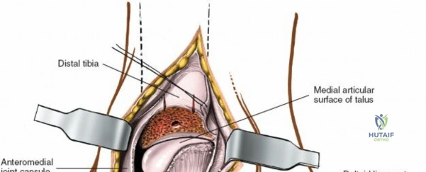 Clinical Image