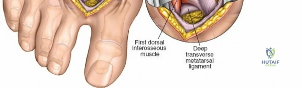 Clinical Image
