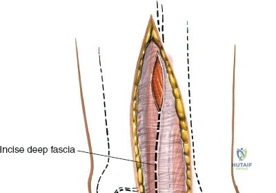 Clinical Image
