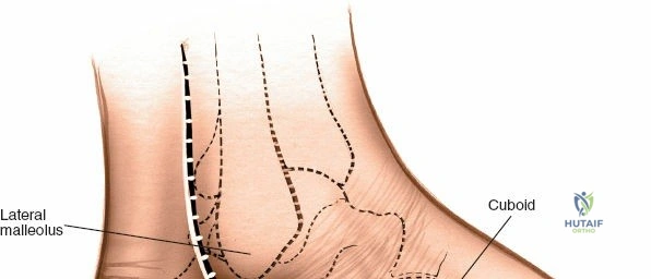 Clinical Image