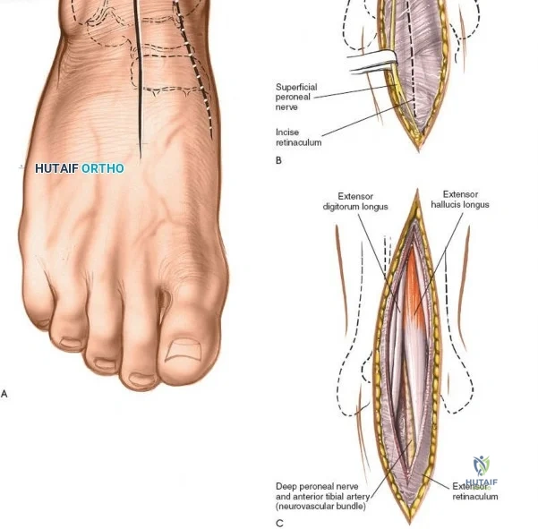Clinical Image