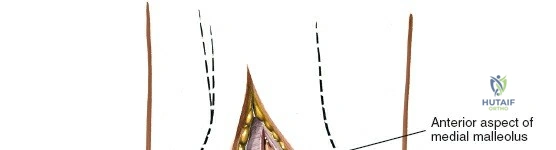 Clinical Image