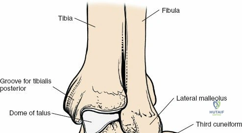 Clinical Image