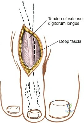 Clinical Image