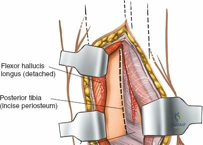 Clinical Image
