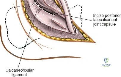 Clinical Image