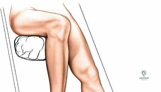Clinical Image