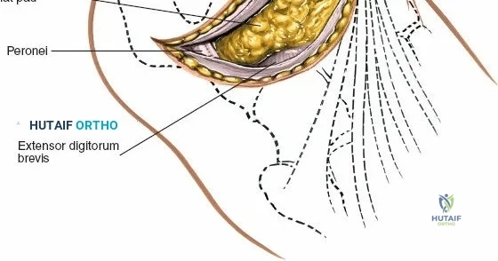 Clinical Image