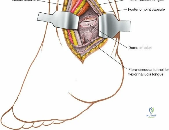 Clinical Image