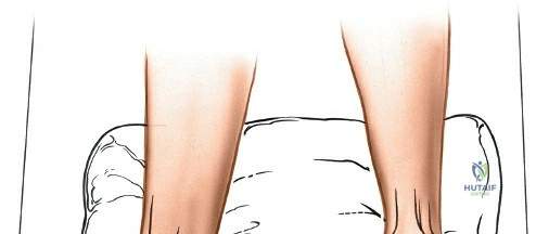 Clinical Image