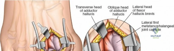 Clinical Image