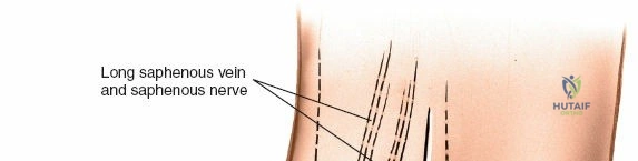 Clinical Image