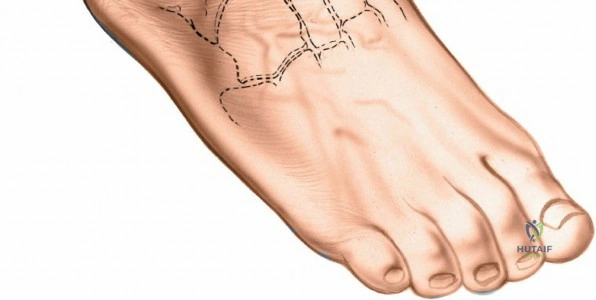 Clinical Image