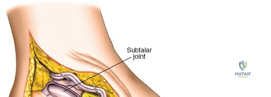Clinical Image