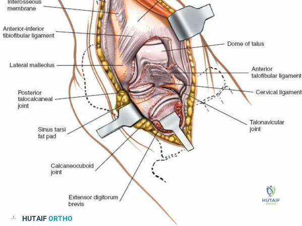 Clinical Image