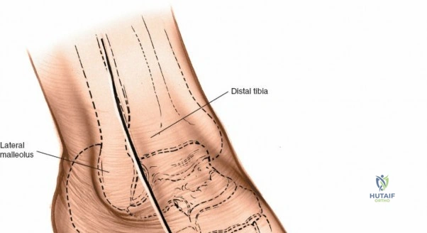 Clinical Image