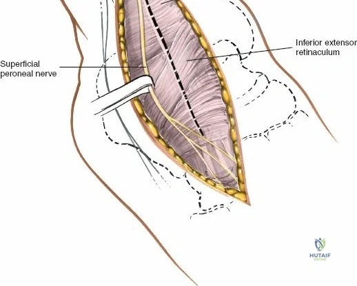 Clinical Image