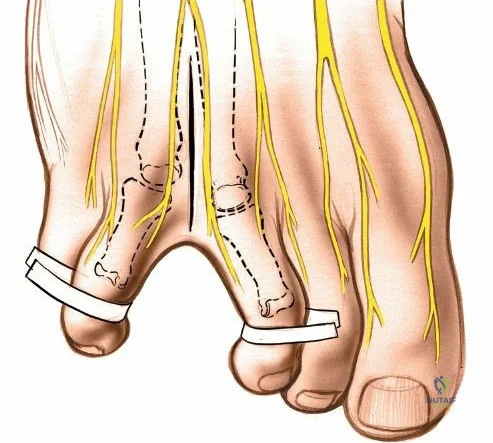 Clinical Image