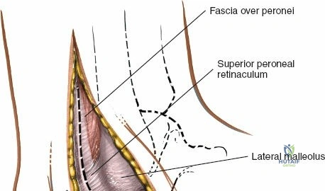 Clinical Image