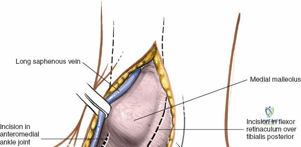 Clinical Image