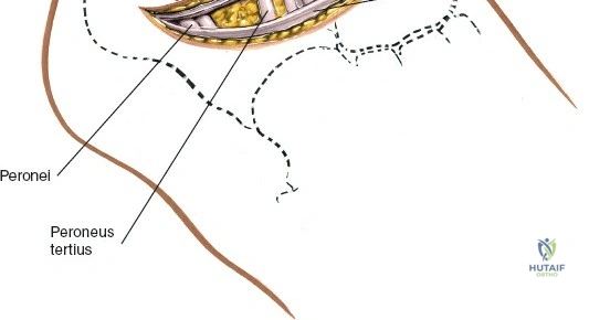 Clinical Image