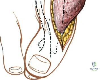 Clinical Image