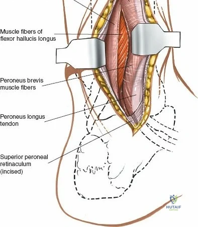 Clinical Image