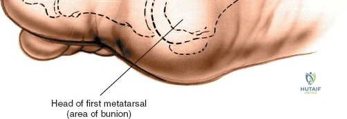 Clinical Image
