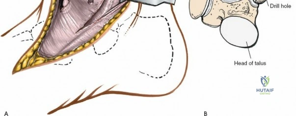Clinical Image
