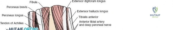 Clinical Image