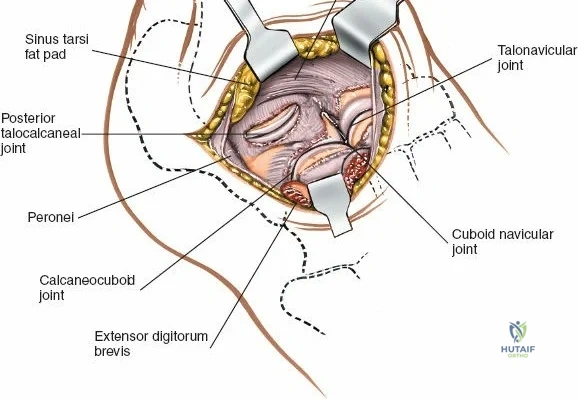 Clinical Image