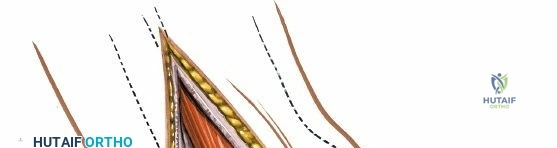 Clinical Image